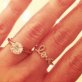Celebrities' engagement rings
