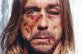 Beaten celebrities appear in anti-torture campaign