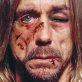 Beaten celebrities appear in anti-torture campaign