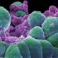 Study: cancer will never disappear